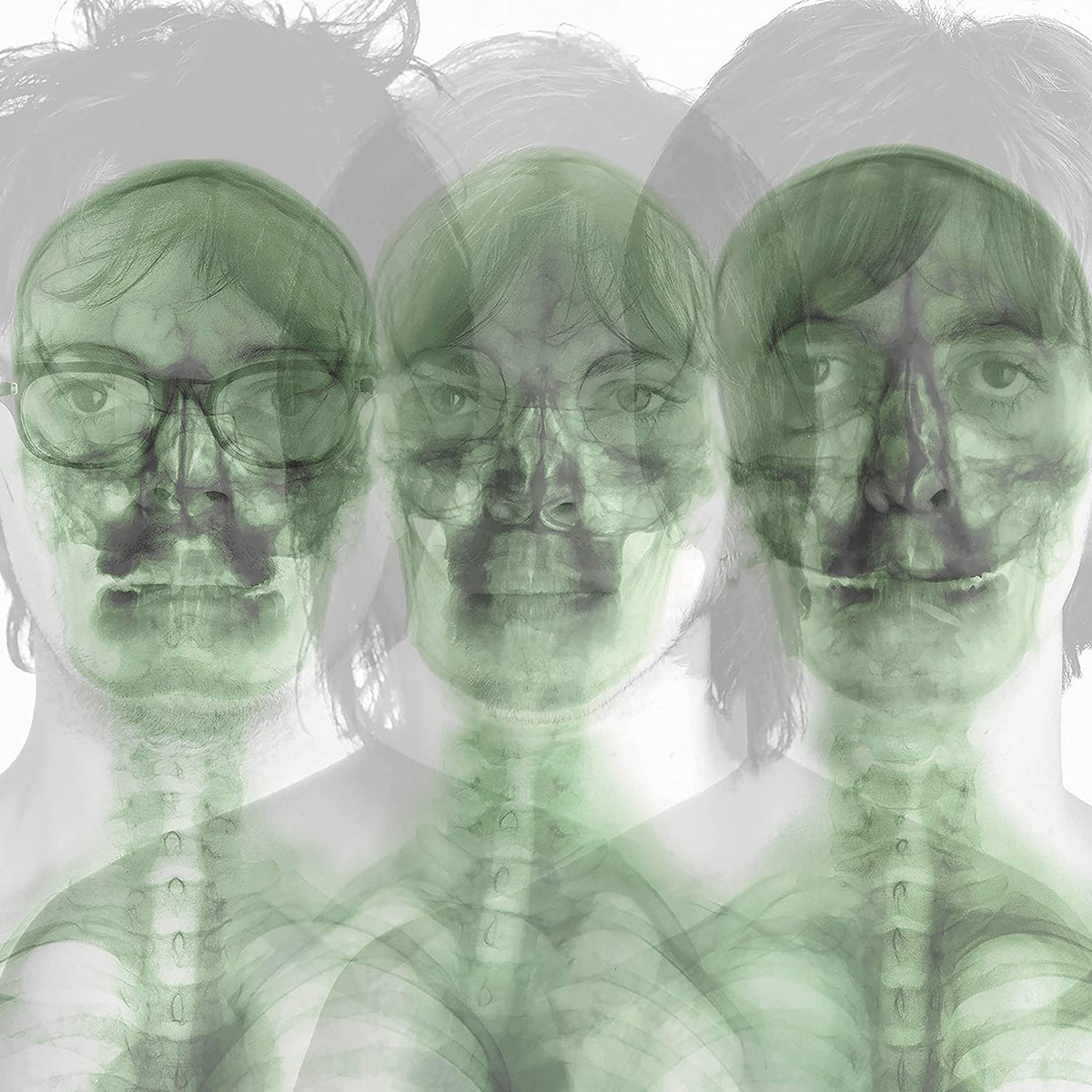 Supergrass/Supergrass (Neon Orange Vinyl) [LP]